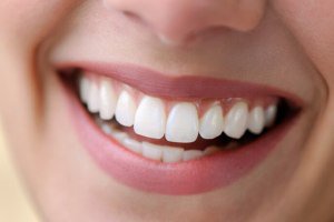 جرم گیری طبیعی دندان در خانه