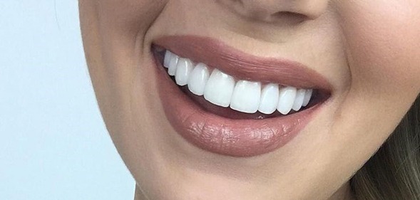 دندان زیبا