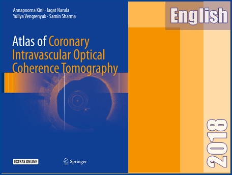 اطلس مقطع نگاری همدوسی اپتیکی داخل عروقی کرونری  Atlas of Coronary Intravascular Optical Coherence Tomography