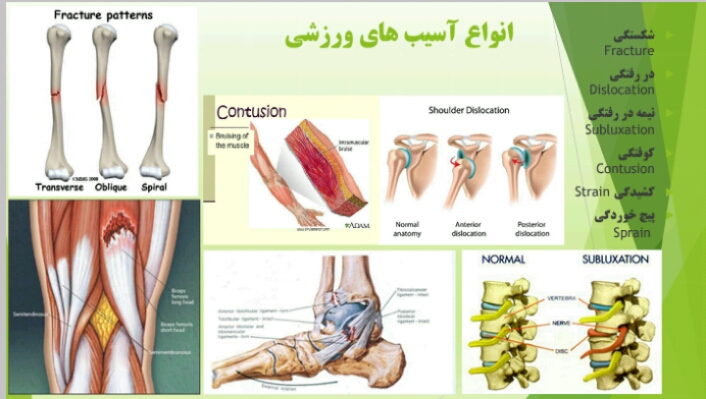 انواع آسیب ورزشی 