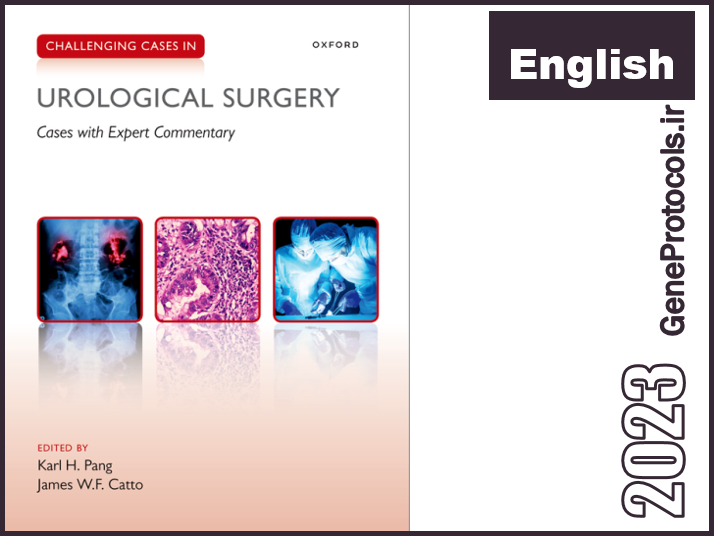 موارد چالش برانگیز در جراحی اورولوژی Challenging Cases in Urological Surgery